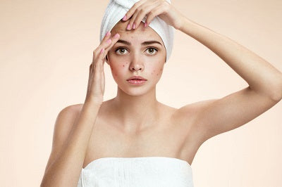 Is a Dead Sea mud mask the pimple cure you've been waiting for?