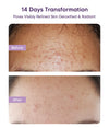 LIQUICK Liquid Mud Mask